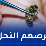 وفاة شخصين وإصابة إثنين آخرين بسبب لسعات النحل بمستغانم